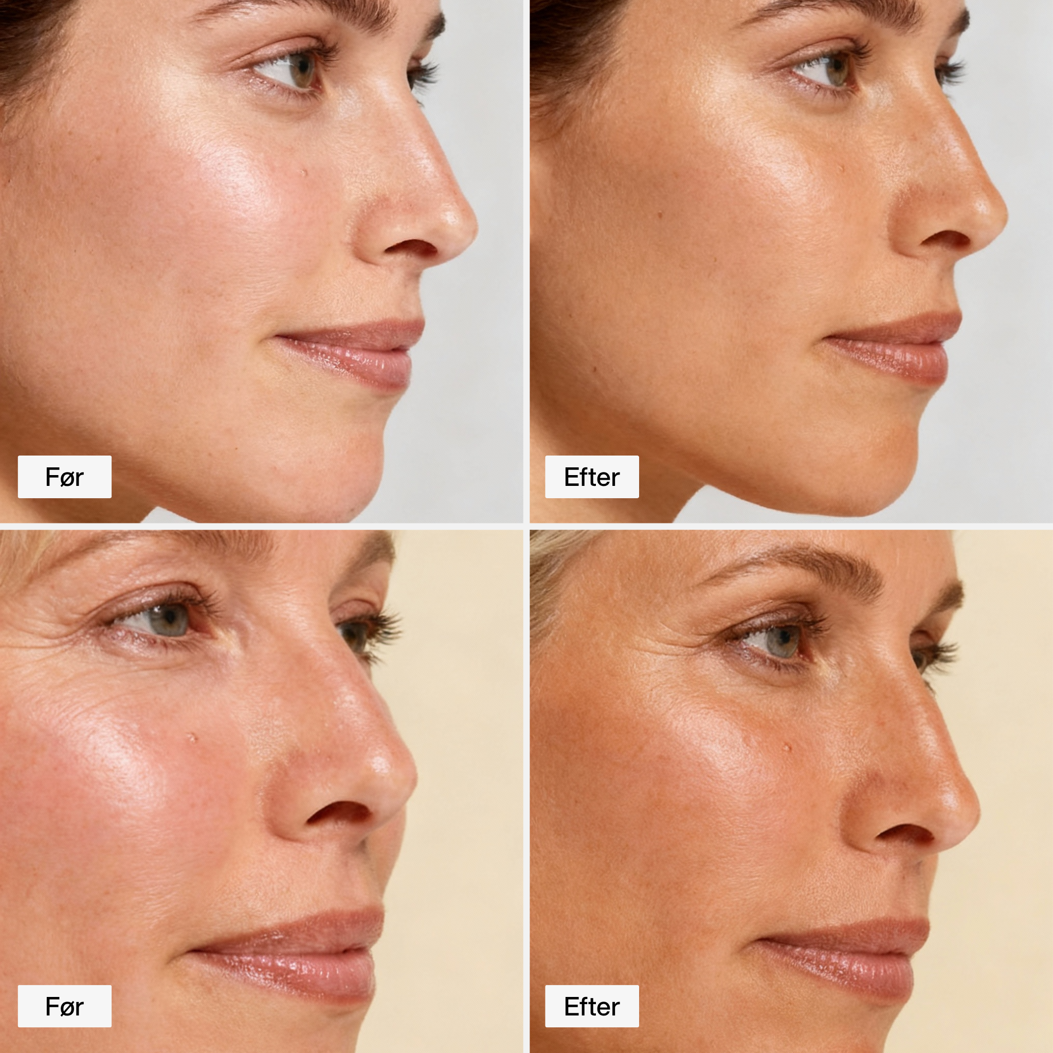 Brun Utan Sol Droppar