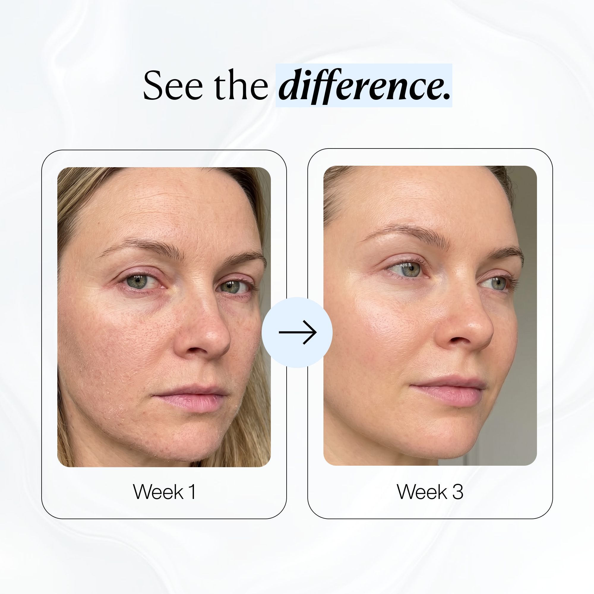 Hydrating Collagen Mask