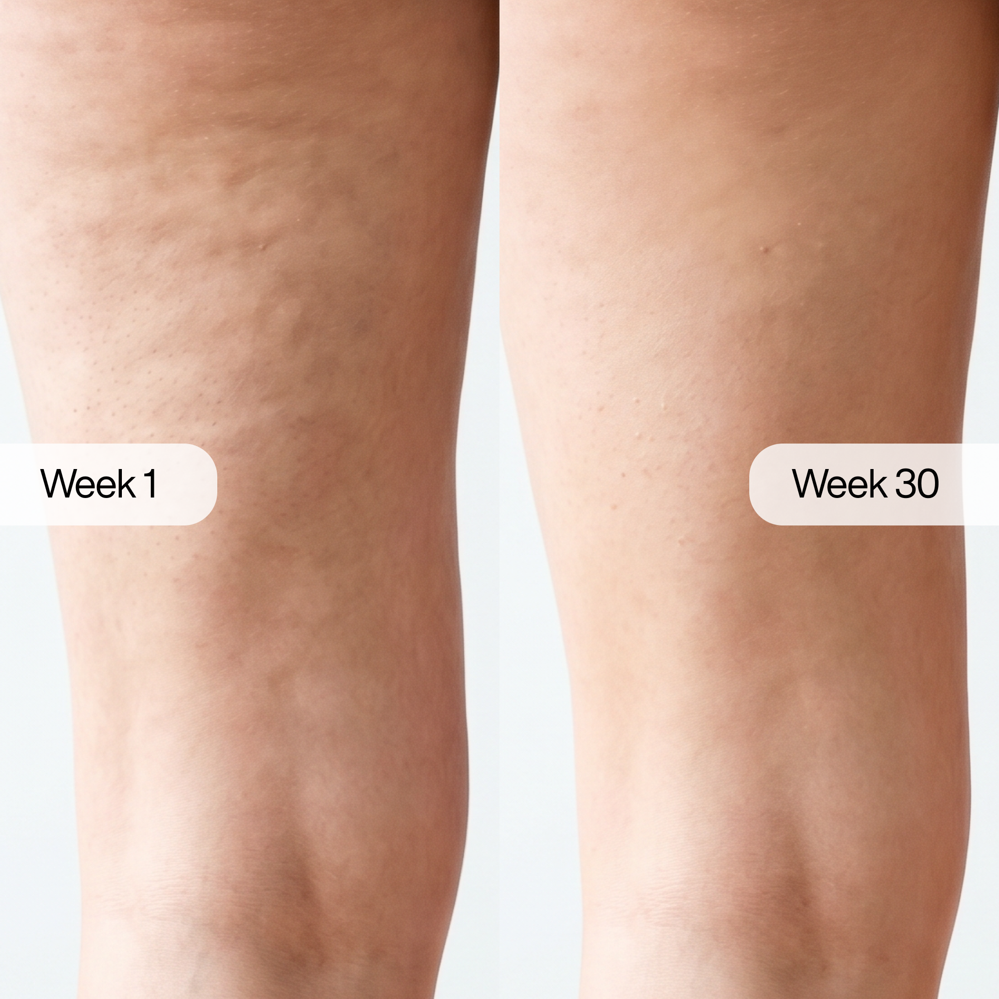 Tighten & Tone Body Cream